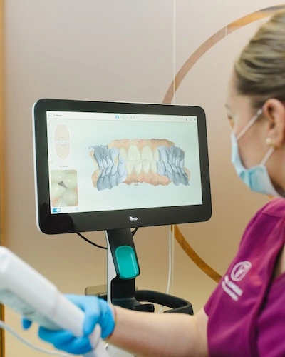 Escaneado intraoral con iTero para planificar un tratamiento de estética dental en el Centro Odontológico Miguel González, clínica dental en Oviedo