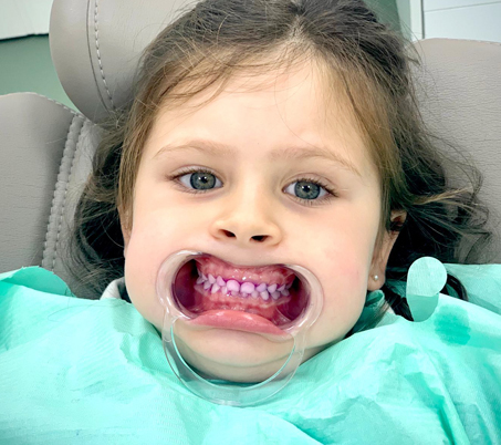 tenir-dientes